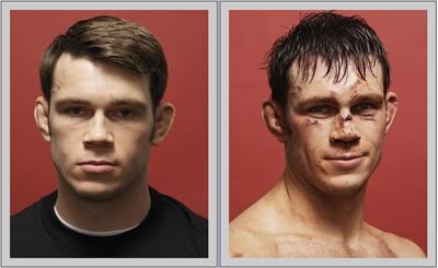 Forrest Griffin