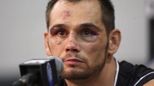 rich franklin's eye