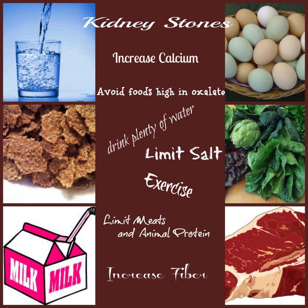 Kidney Stone Prevention kidney stone