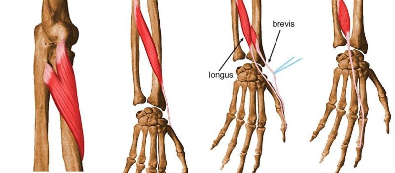 extensor pollicis brevis and extensor pollicis longus