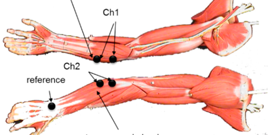 flexor carpi ulnaris