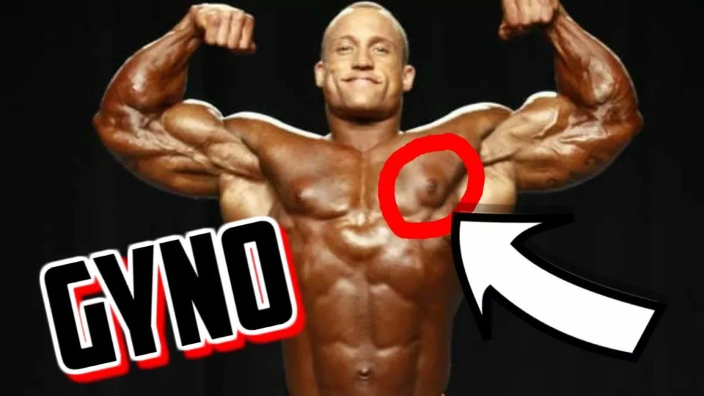 How to Get Rid of Gyno