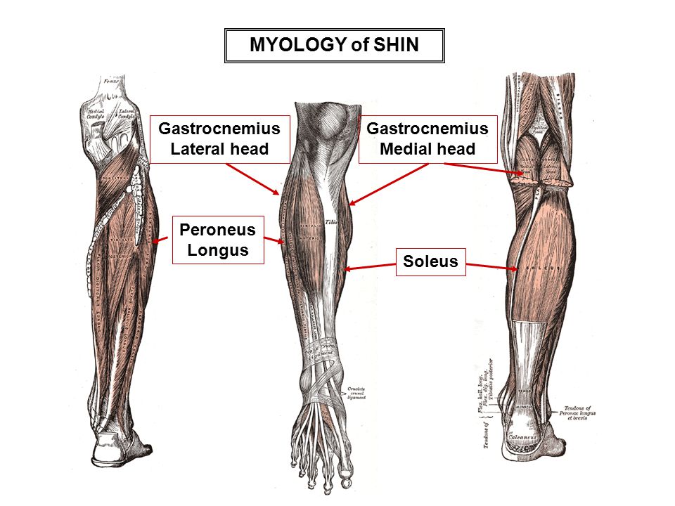 lateral head of the gastrocnemius