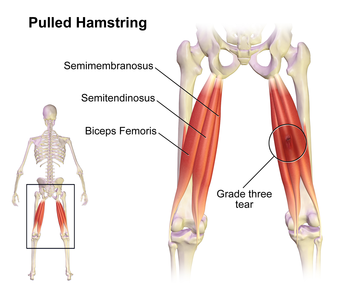 semimembranosus of the hamstrings