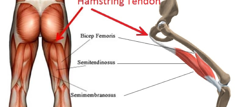 semitendinosus of the hamstrings