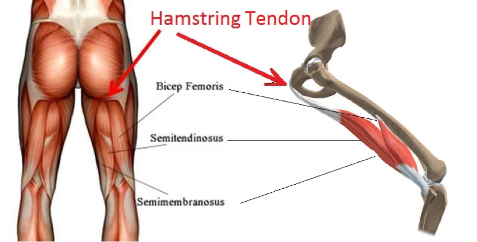 semitendinosus of the hamstrings