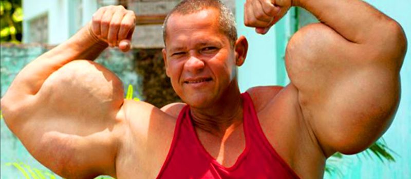 steroids abuse